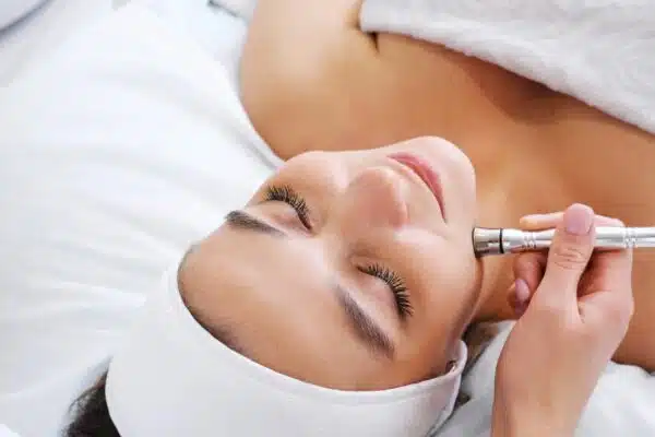 Diamond Microdermabrasion with AHA