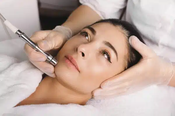 Diamond Microdermabrasion with AHA and Facial Massage