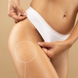 Bikini - Nordic Skin College